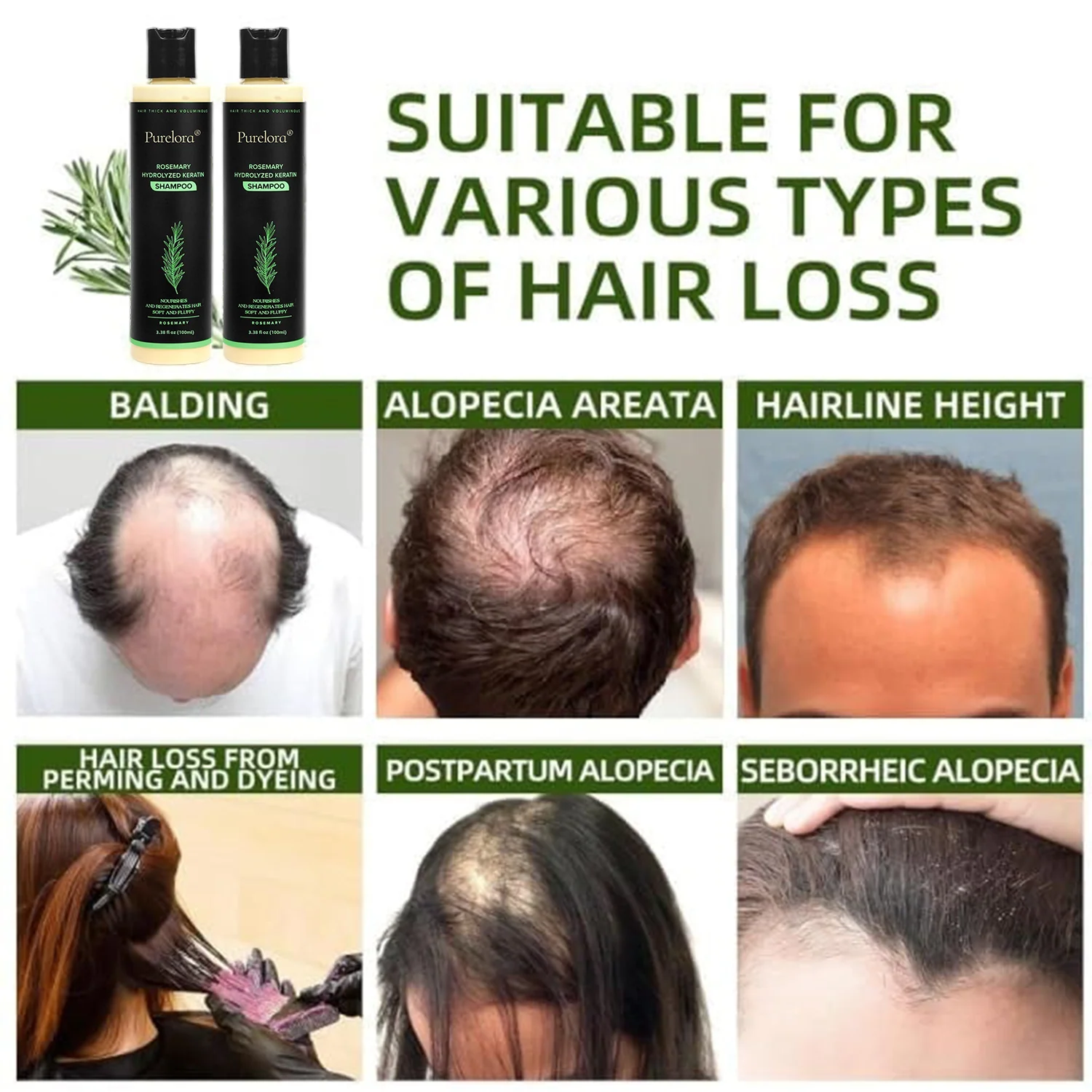 🔥LAST DAY 50% OFF - 🎅Purelora® Organic Rosemary Hair Growth Shampoo - Image 2